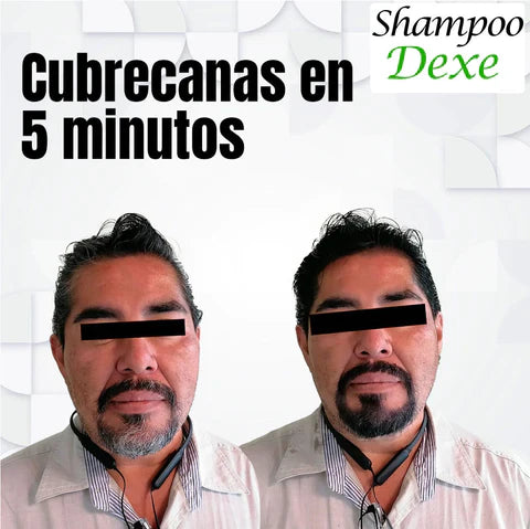 Shampoo Cubre Canas DEXE